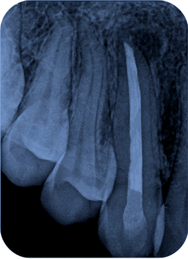 Figure 9