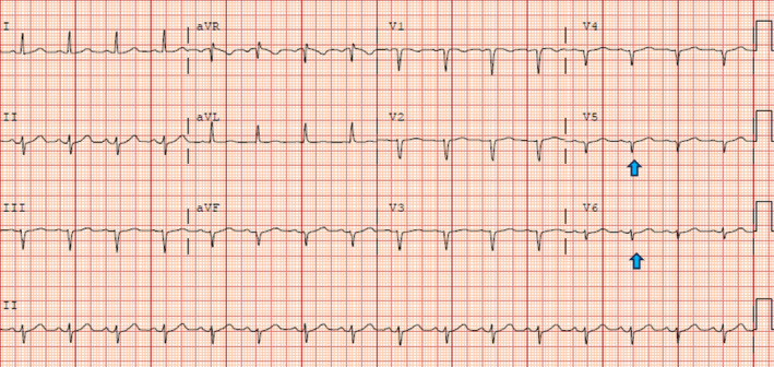 Figure 5