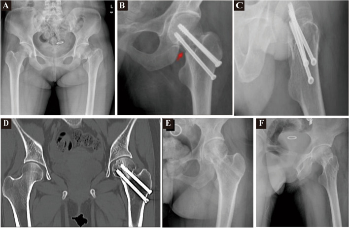 Figure 2