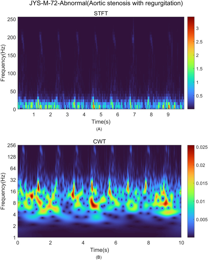 Fig 3
