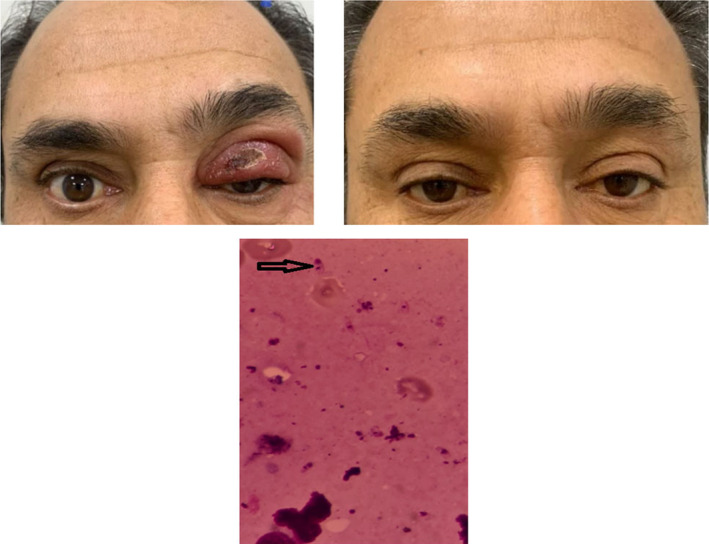 FIGURE 1