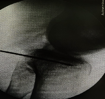 Figure 9