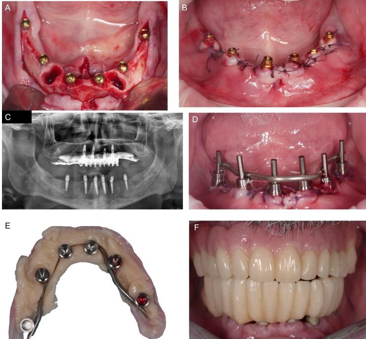Figure 4