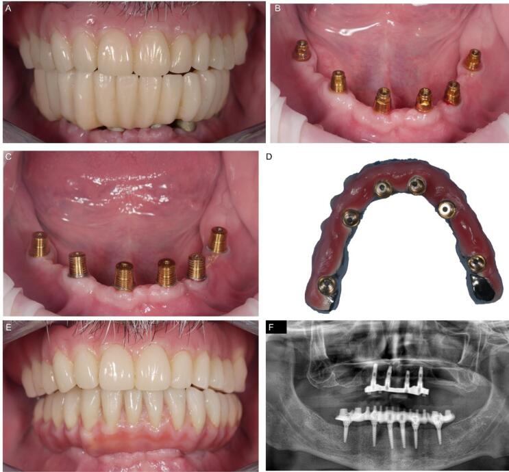 Figure 5