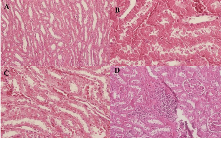 Figure 11