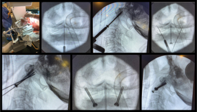 Fig. 2