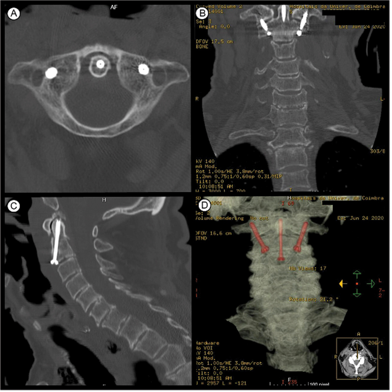 Fig. 4