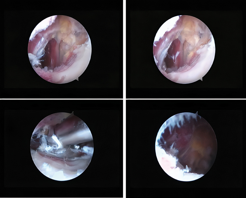 Fig. 4
