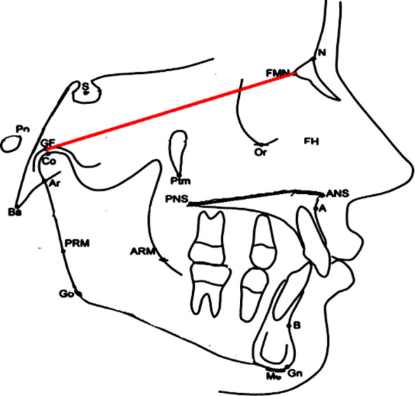 Fig.1
