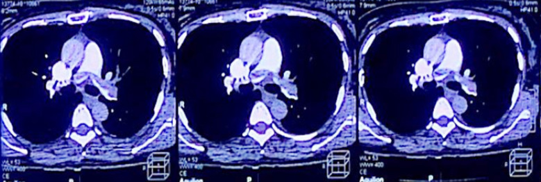 Fig.1