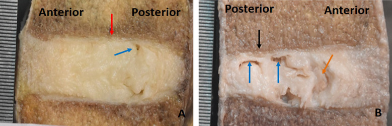 Fig.2