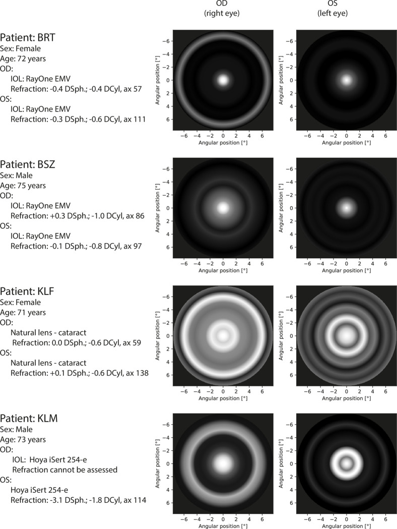 Figure 14