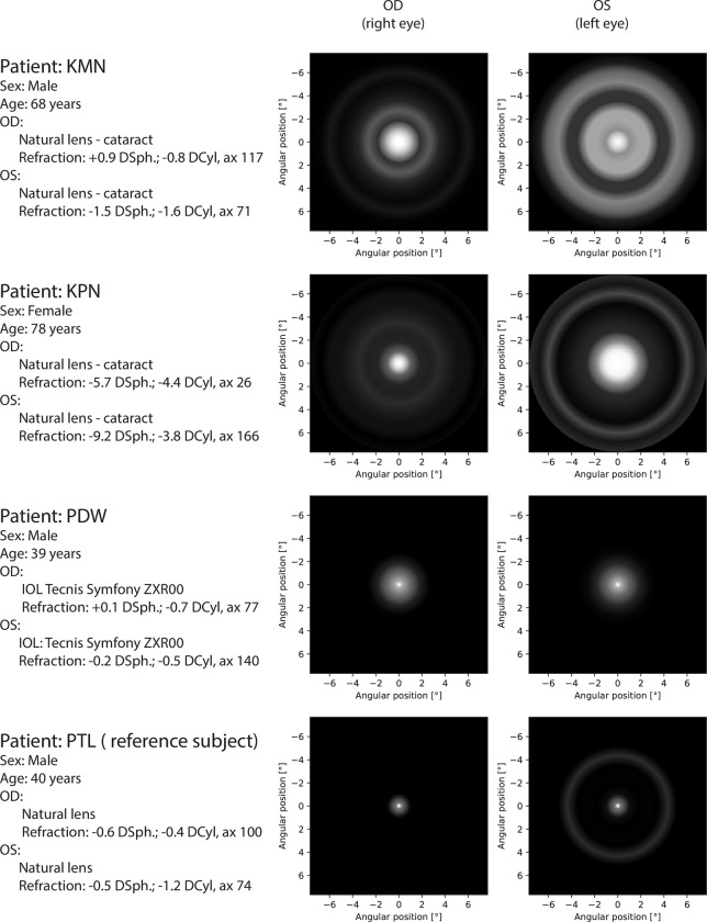 Figure 15