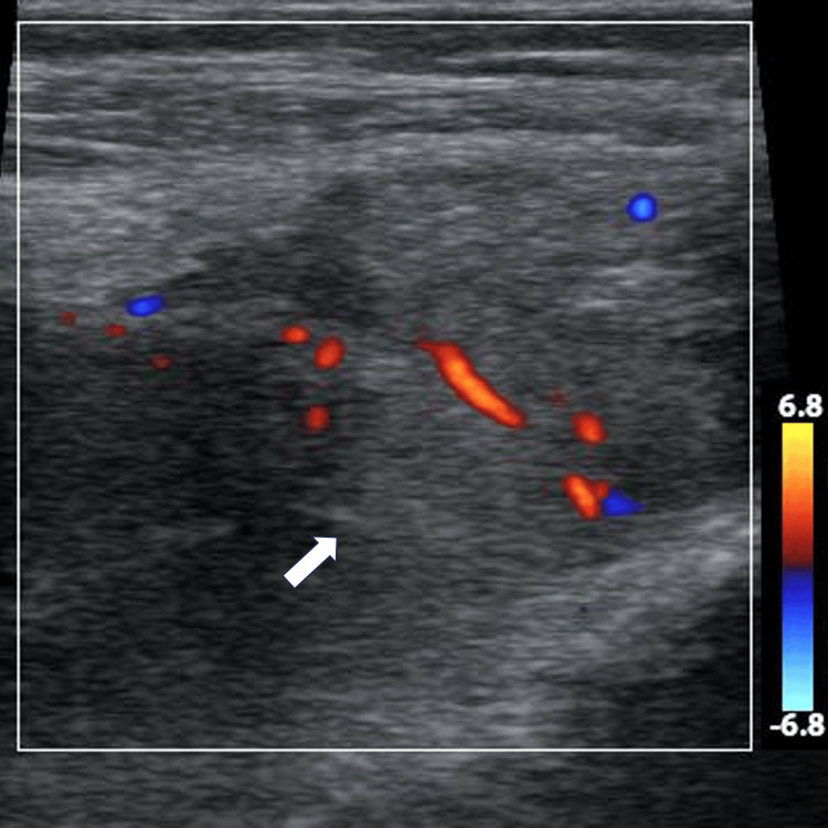 Figure 6