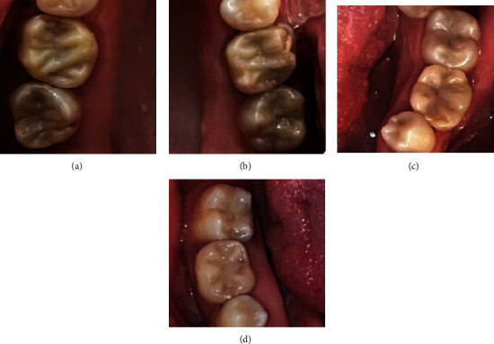 Figure 10