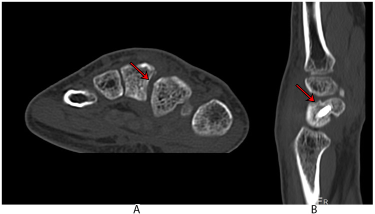 Figure 5