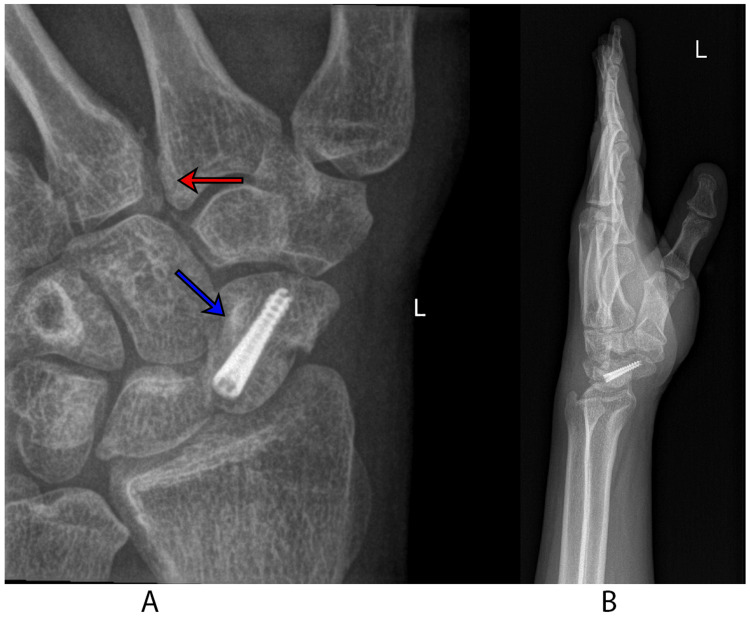 Figure 6