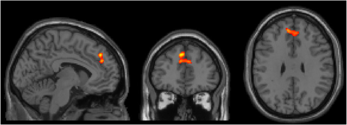 FIGURE 3