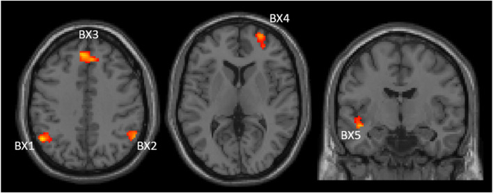 FIGURE 4