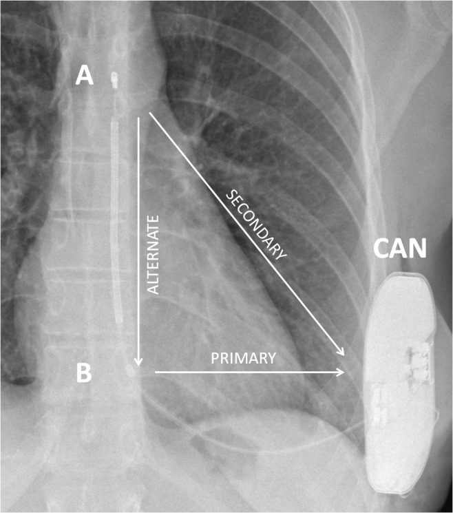 Fig. 1