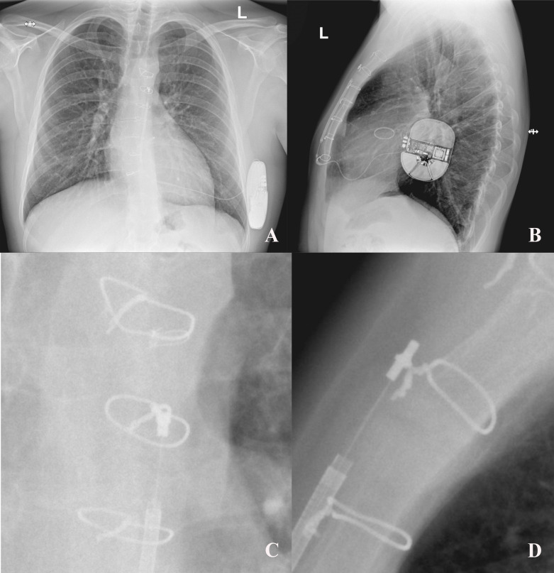 Fig. 4