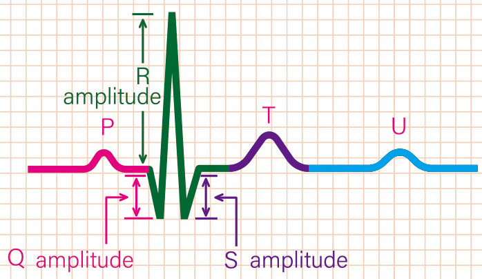 Fig. 2