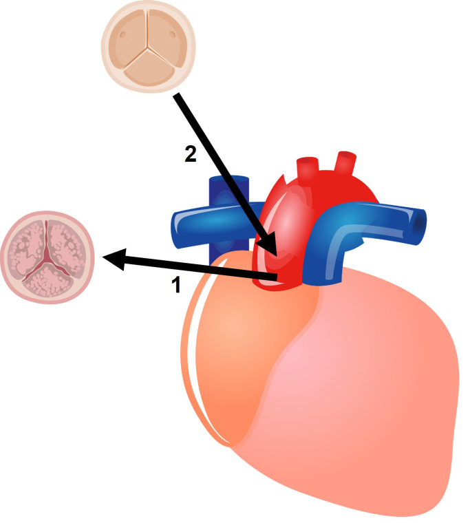Fig. 2