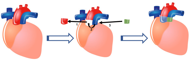 Fig. 3