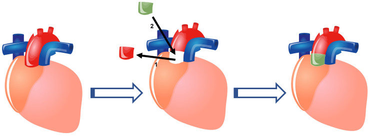 Fig. 4