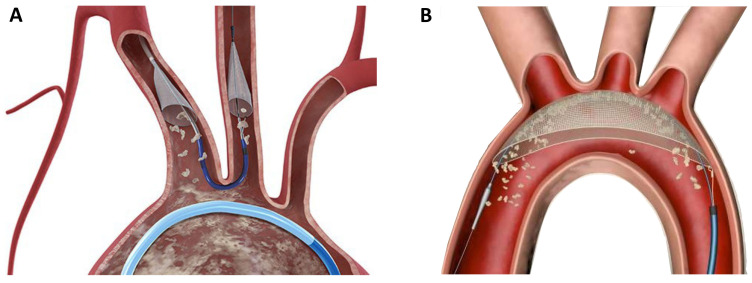 Fig. 5