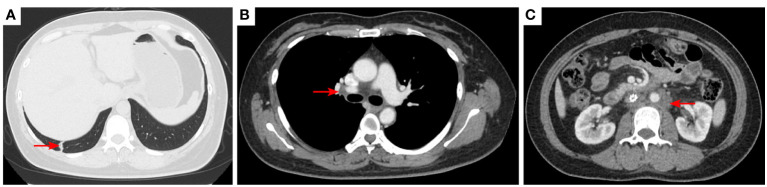 Figure 9