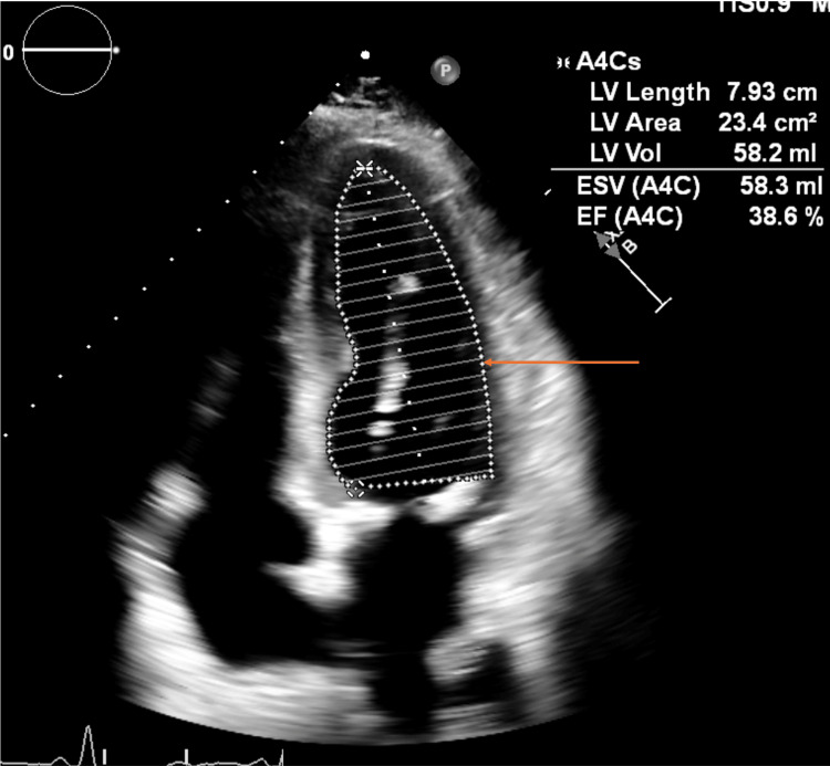 Figure 4