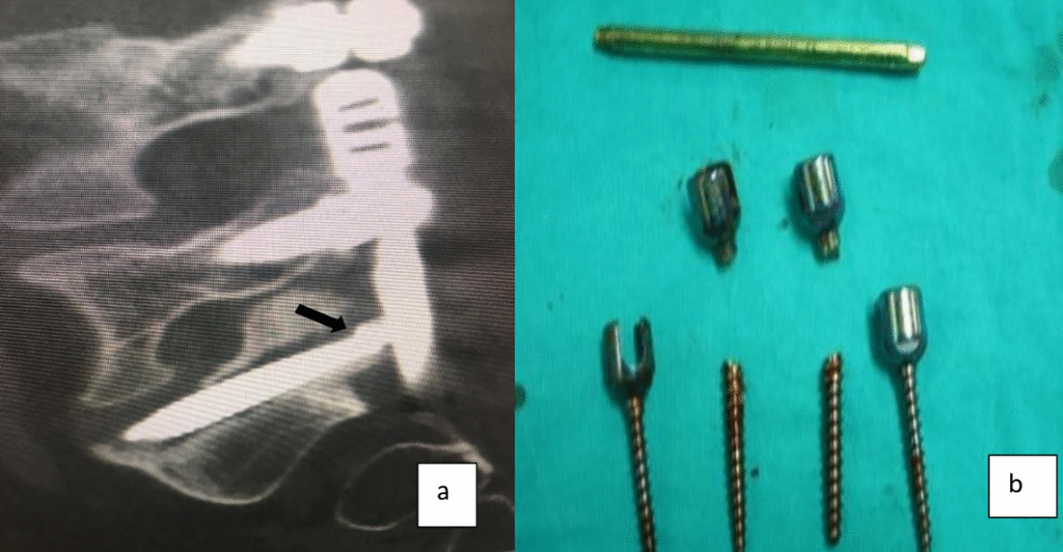 Figure 10