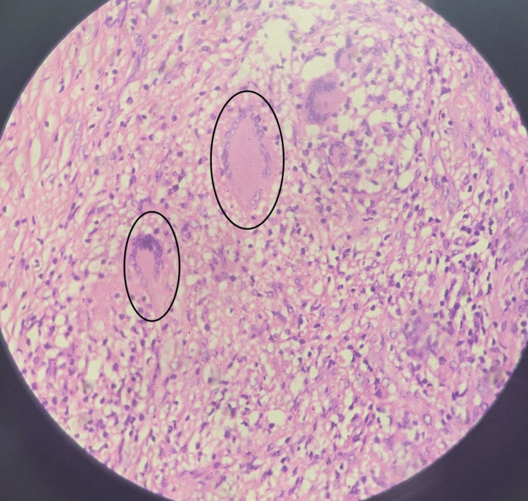 Figure 11