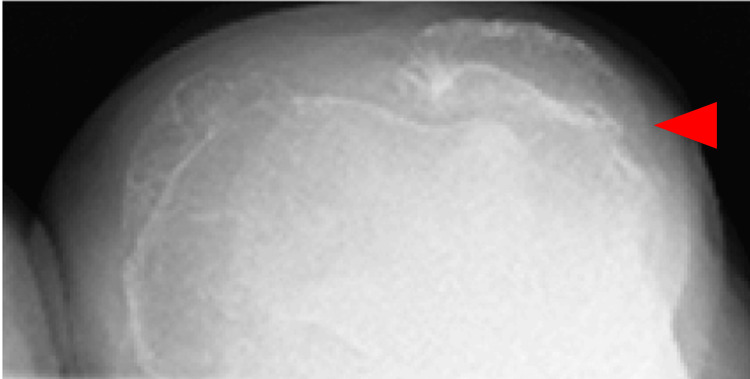 Figure 9
