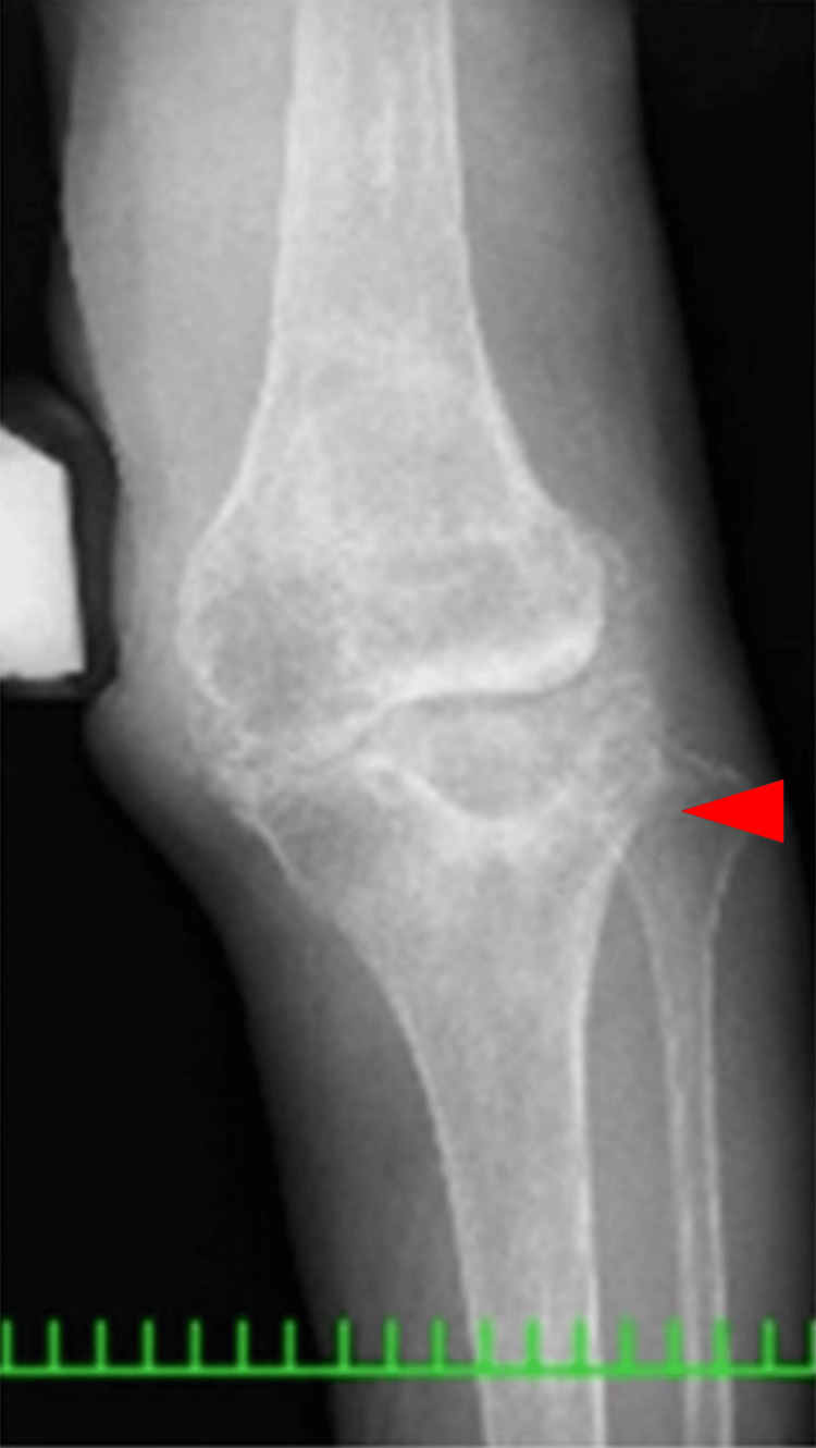 Figure 10