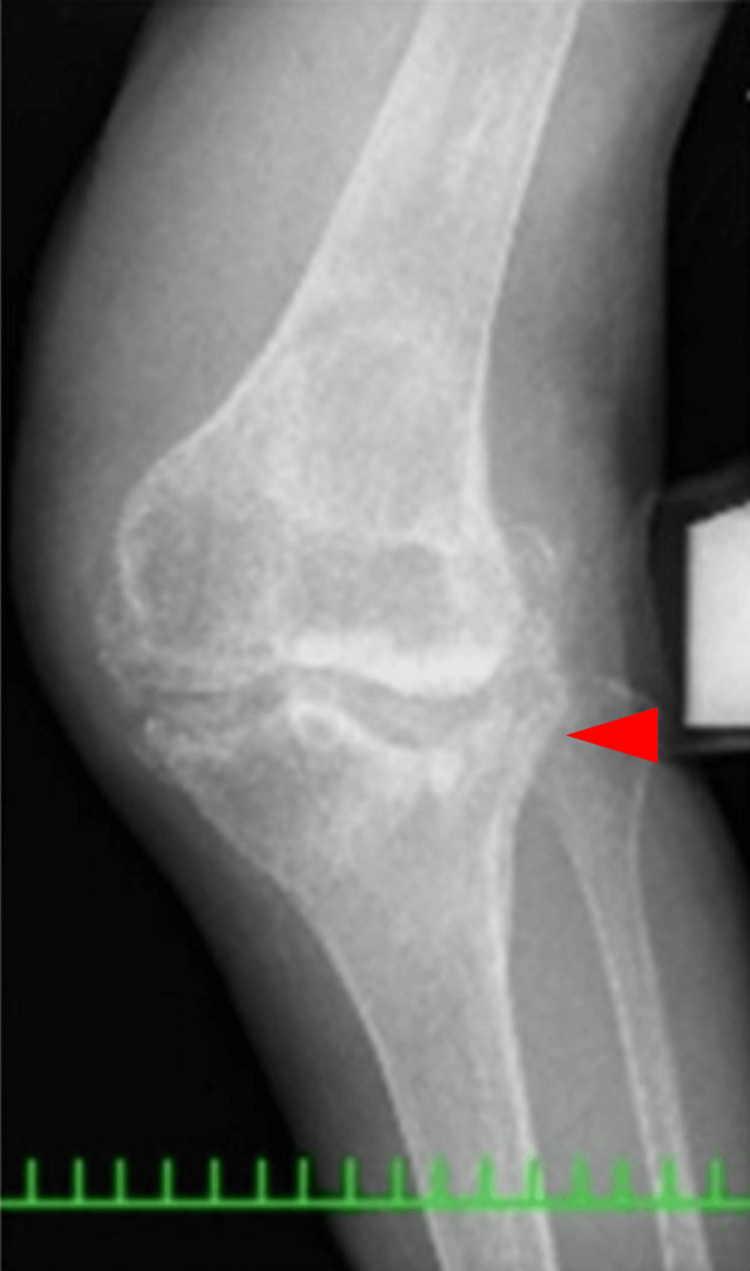 Figure 11