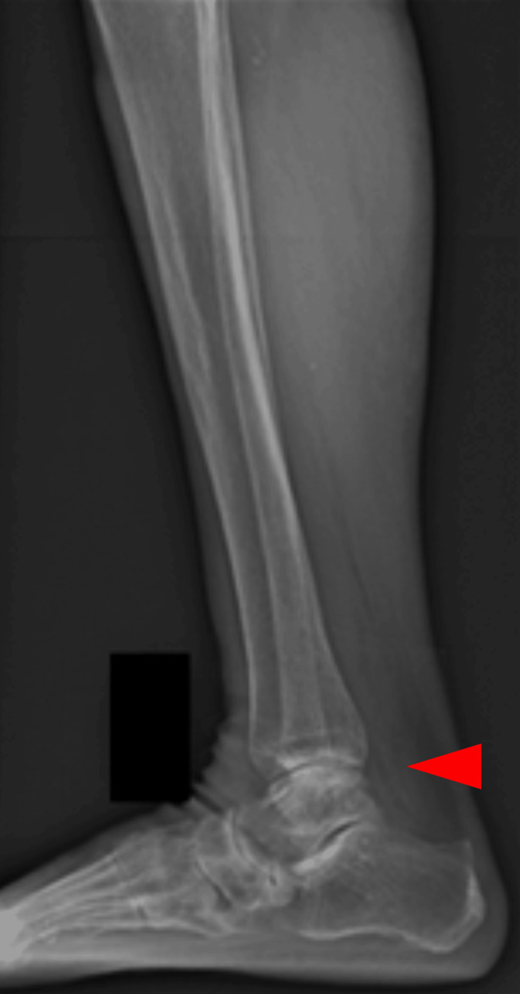 Figure 12