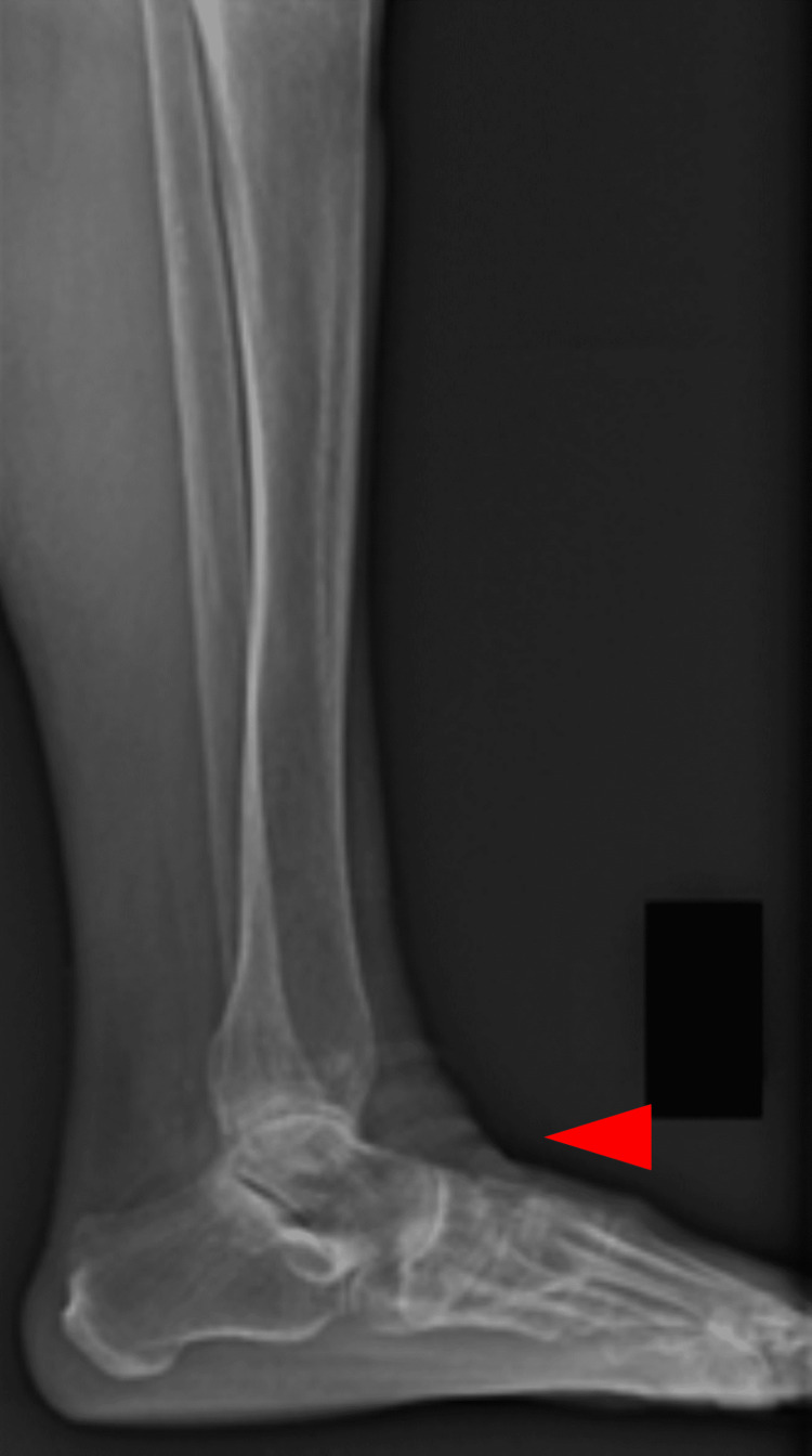 Figure 13