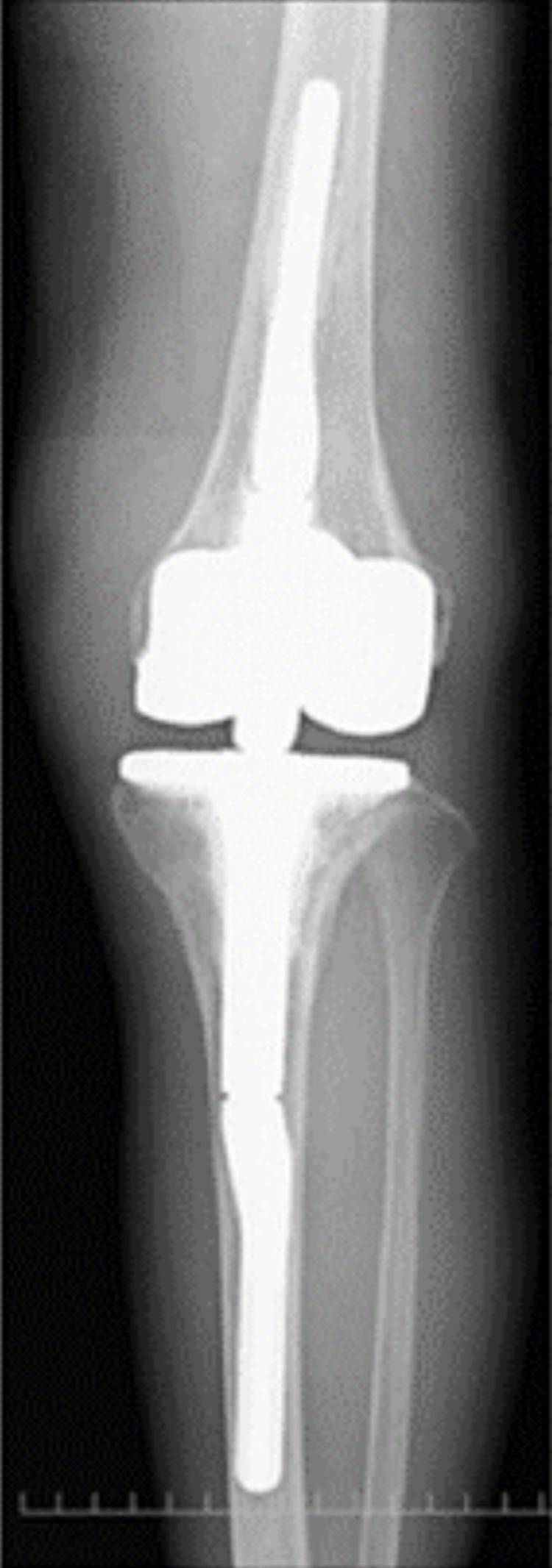 Figure 14