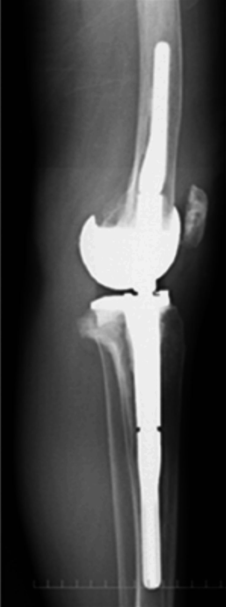Figure 15