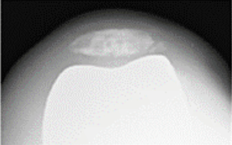 Figure 16