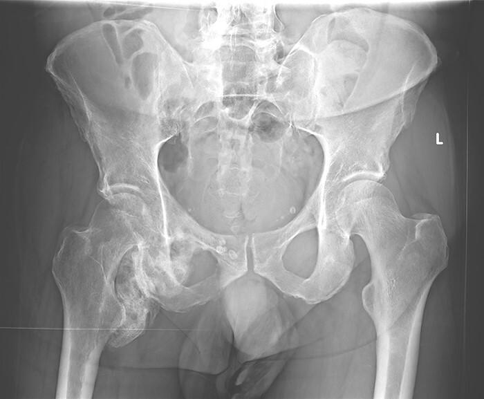 Fig. 1