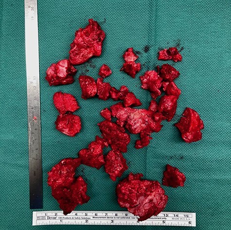 Fig. 6