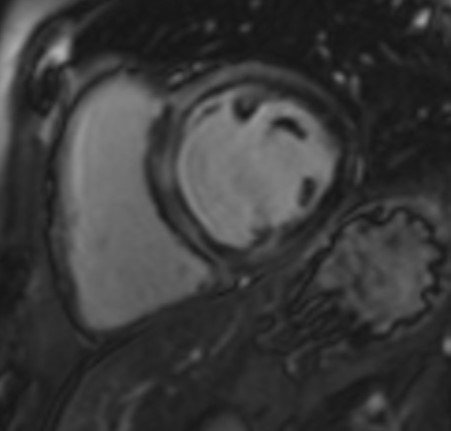 Fig. 5