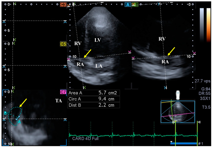 Figure 3