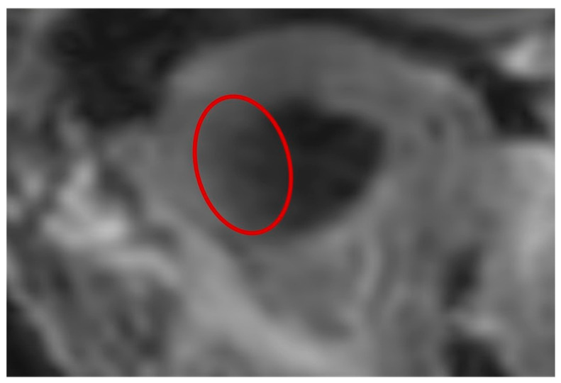 Figure 9