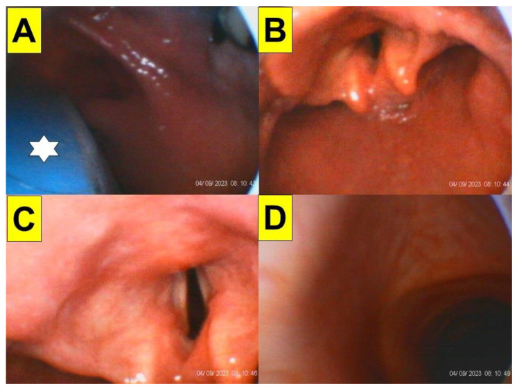Figure 9