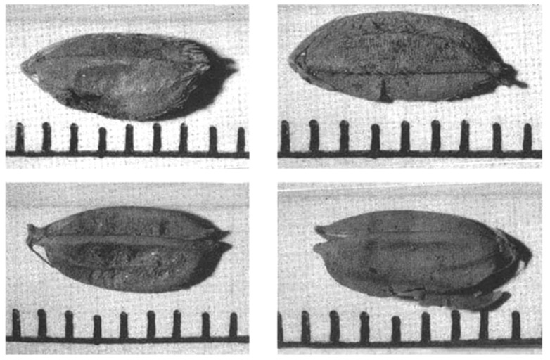 Figure 17