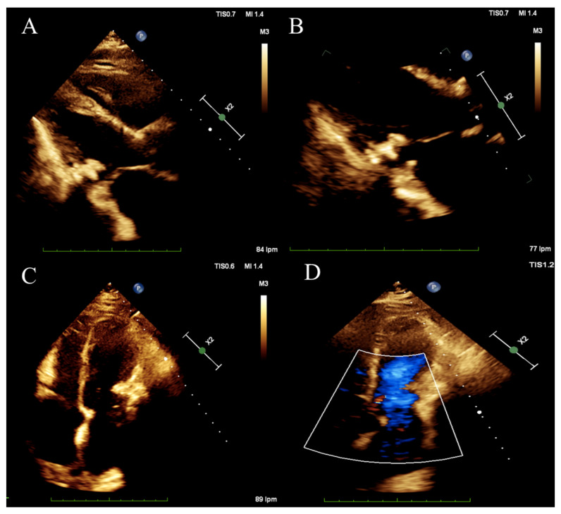 Figure 2